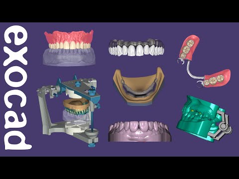 Highlights of exocad DentalCAD Plovdiv, version 2.4