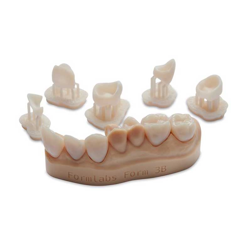 TEMP - Resina Dental Biocompatible para Coronas Temporales - Creativo 3D