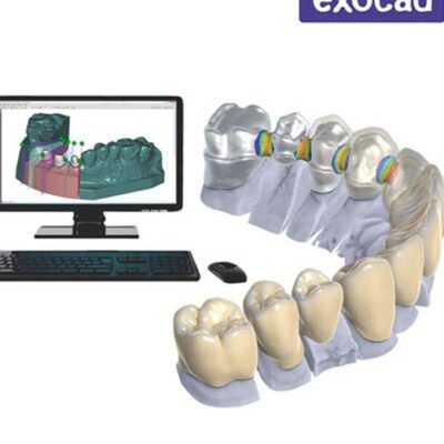 exocad software dental