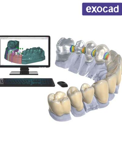 exocad software dental