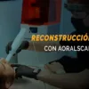reconstrucción dental