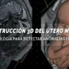 reconstrucción 3d