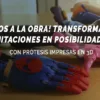 prótesis impresas en 3d