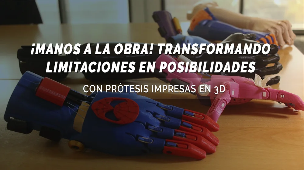 prótesis impresas en 3d