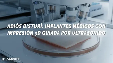 impresión 3D guiada por ultrasonido